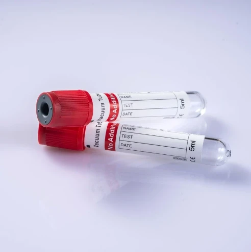 Red Top Blood Collection Tube (No Additive/Plain) For Serum & Clotting Tests factory